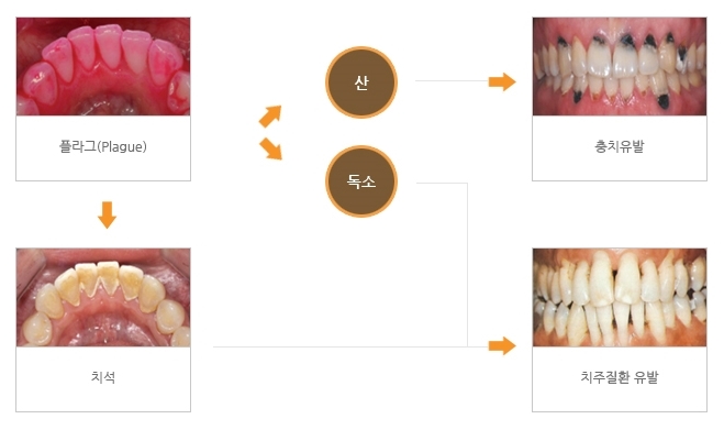 스케일링.jpg